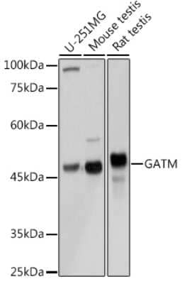 Western Blot: GATM AntibodyAzide and BSA Free [NBP3-04578]